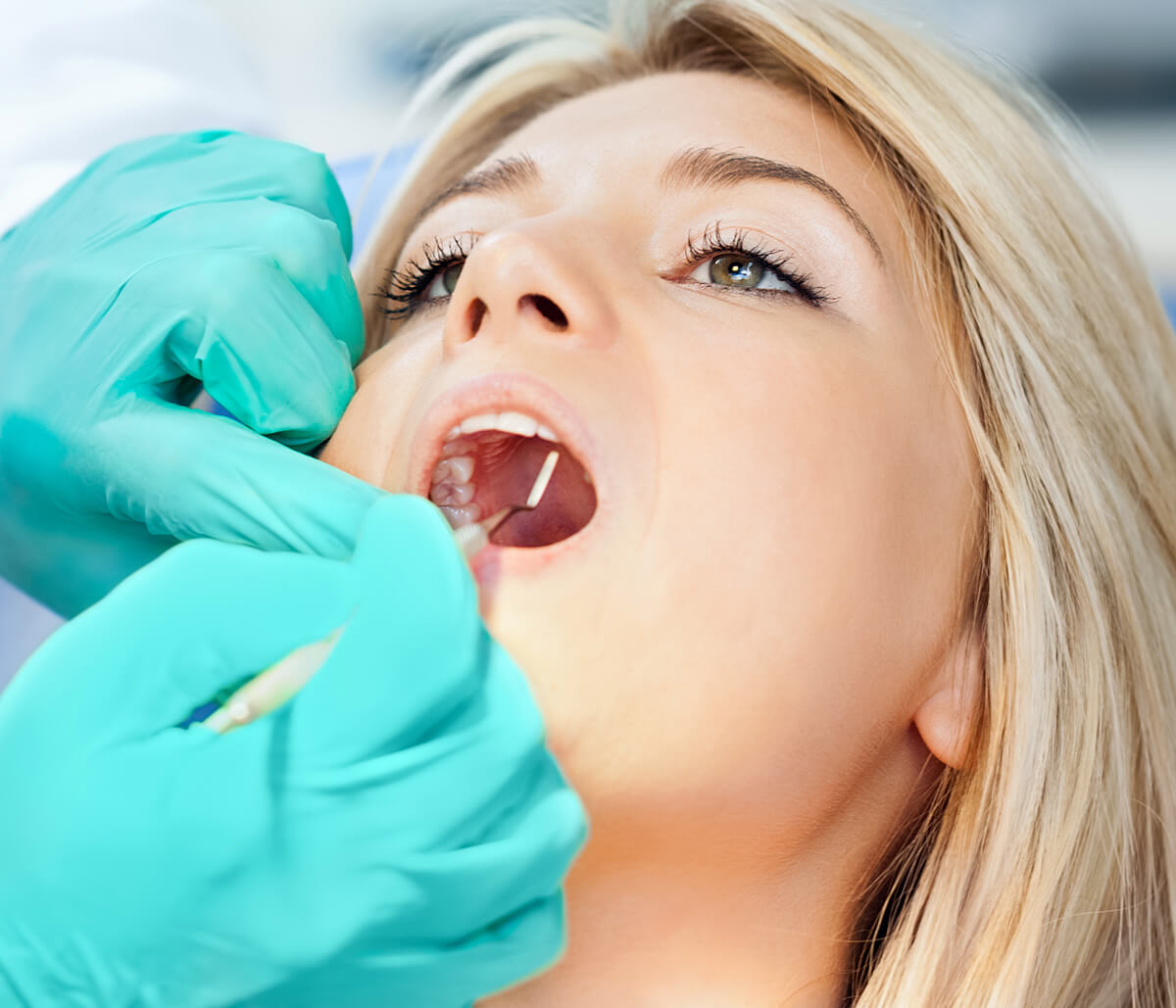 The Importance of the 20th Second Premolar Tooth for Fort Lauderdale, FL Area, Patients